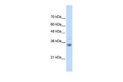 Western Blot: HOXB4 Antibody [NBP3-10514]