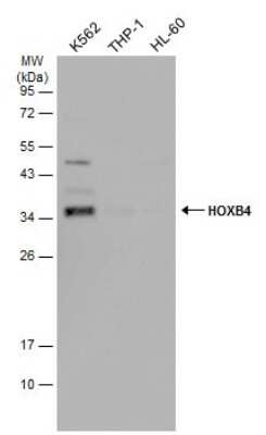 Western Blot: HOXB4 Antibody [NBP3-13347]