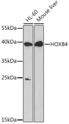 Western Blot: HOXB4 AntibodyAzide and BSA Free [NBP3-15493]