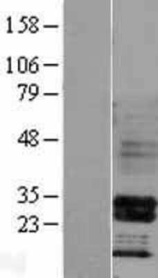 Western Blot: HOXB4 Overexpression Lysate [NBL1-11671]