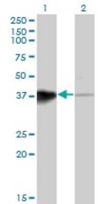 Western Blot: HOXB5 Antibody (3F10) [H00003215-M01]