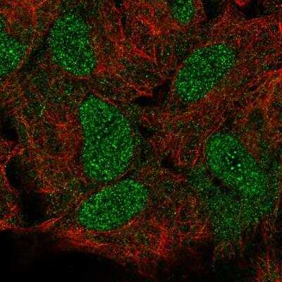 Immunocytochemistry/ Immunofluorescence: HOXB5 Antibody [NBP2-57333]