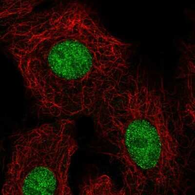 Immunocytochemistry/ Immunofluorescence: HOXB5 Antibody [NBP2-68654]