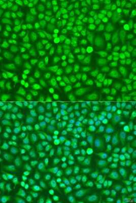 Immunocytochemistry/ Immunofluorescence: HOXB5 Antibody - Azide and BSA Free [NBP3-04470]