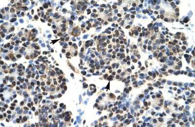 Immunohistochemistry: HOXB5 Antibody [NBP3-10906]