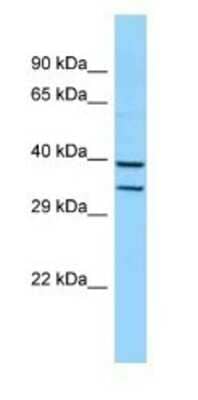 Western Blot: HOXB5 Antibody [NBP1-98351]