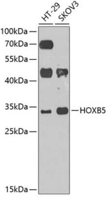 Western Blot: HOXB5 AntibodyAzide and BSA Free [NBP3-04470]