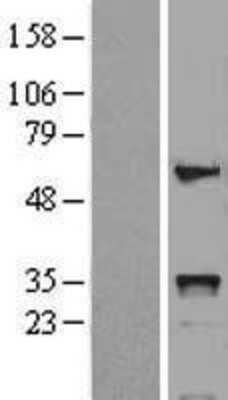 Western Blot: HOXB5 Overexpression Lysate [NBL1-11672]