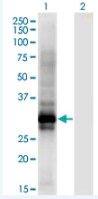 Western Blot: HOXB6 Antibody (8E3) [H00003216-M01-100ug]