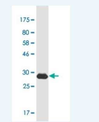 Western Blot: HOXB6 Antibody (8E3) [H00003216-M01-100ug]