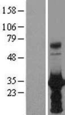 Western Blot: HOXB6 Overexpression Lysate [NBL1-11673]