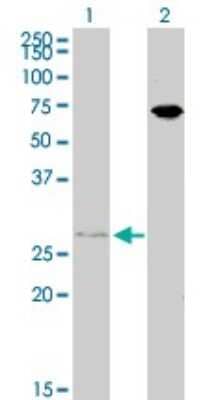 Western Blot: HOXB7 Antibody (4A3) [H00003217-M02]