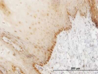 Immunohistochemistry-Paraffin: HOXB7 Antibody (4C6) [H00003217-M03]