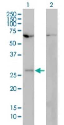 Western Blot: HOXB7 Antibody (4F9) [H00003217-M01]