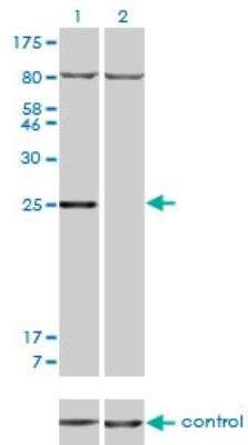 Western Blot: HOXB7 Antibody (5B2) [H00003217-M04]