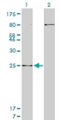 Western Blot: HOXB7 Antibody (5B2) [H00003217-M04]