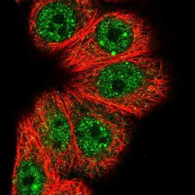 Immunocytochemistry/ Immunofluorescence: HOXB7 Antibody [NBP2-14098]