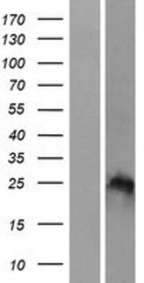 Western Blot: HOXB7 Overexpression Lysate [NBP2-07868]