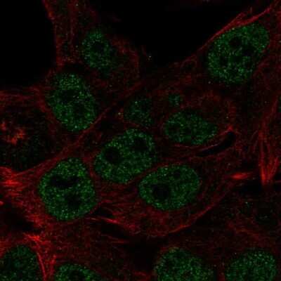 Immunocytochemistry/ Immunofluorescence: HOXB8 Antibody [NBP2-56537]