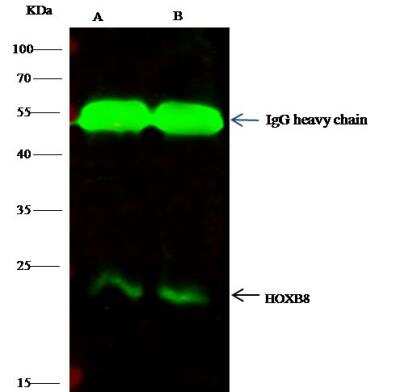 Immunoprecipitation: HOXB8 Antibody [NBP2-98722]