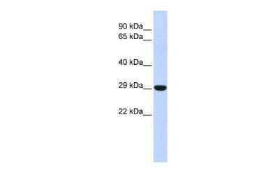 Western Blot: HOXB8 Antibody [NBP2-83058]