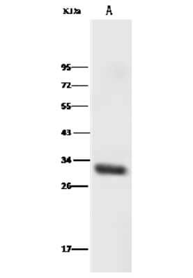 Western Blot: HOXB8 Antibody [NBP2-99554]