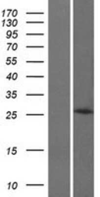 Western Blot: HOXB8 Overexpression Lysate [NBP2-06361]