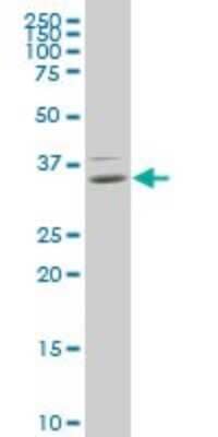 Western Blot: HOXB9 Antibody (3C8) [H00003219-M01]