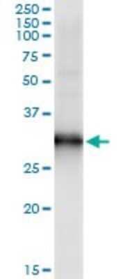 Western Blot: HOXB9 Antibody (4C11) [H00003219-M05]