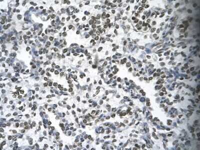 Immunohistochemistry-Paraffin: HOXB9 Antibody [NBP3-10949]