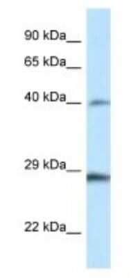 Western Blot: HOXB9 Antibody [NBP1-82370]