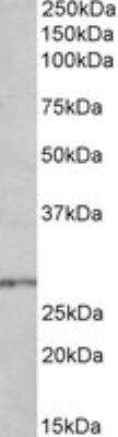 Western Blot: HOXB9 Antibody [NBP2-27467]