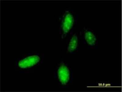 Immunocytochemistry/ Immunofluorescence: HOXC10 Antibody (3F2) [H00003226-M01]