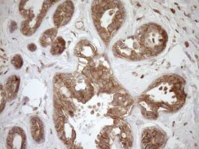 Immunohistochemistry: HOXC10 Antibody (OTI5C10) [NBP2-46000]