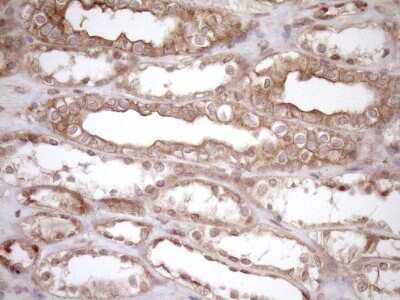 Immunohistochemistry: HOXC10 Antibody (OTI5C10) [NBP2-46000]