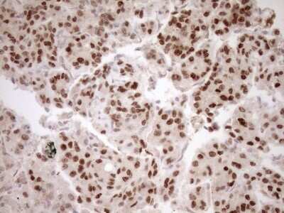 Immunohistochemistry: HOXC10 Antibody (OTI5C10) [NBP2-46000]