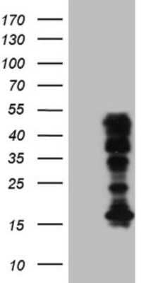 Western Blot: HOXC10 Antibody (OTI5C10) [NBP2-46000]