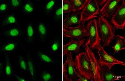 Immunocytochemistry/ Immunofluorescence: HOXC10 Antibody [NBP2-16874]