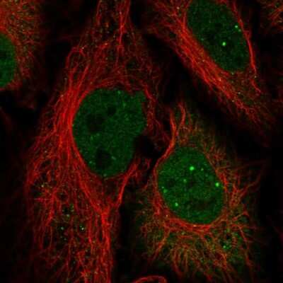 Immunocytochemistry/ Immunofluorescence: HOXC10 Antibody [NBP2-33699]