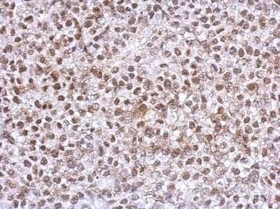 Immunohistochemistry-Paraffin: HOXC10 Antibody [NBP2-16874]