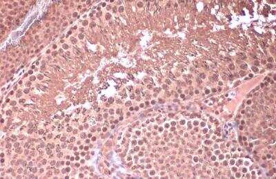 Immunohistochemistry-Paraffin: HOXC10 Antibody [NBP2-16874]