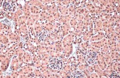 Immunohistochemistry-Paraffin: HOXC10 Antibody [NBP2-16874]