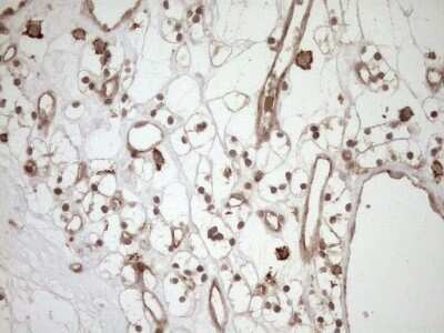 Immunohistochemistry: HOXC10 Antibody (OTI5C10) - Azide and BSA Free [NBP2-70909]