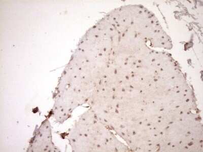 Immunohistochemistry: HOXC10 Antibody (OTI5C10) - Azide and BSA Free [NBP2-70909]