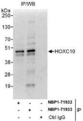 Western Blot: HOXC10 Antibody [NBP1-71932]