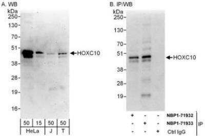 Western Blot: HOXC10 Antibody [NBP1-71933]