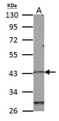 Western Blot: HOXC10 Antibody [NBP2-16874]