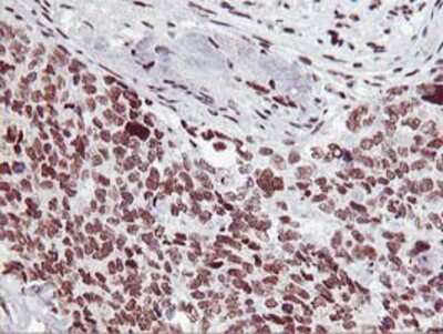 Immunohistochemistry-Paraffin: HOXC11 Antibody (OTI3E10) [NBP2-00499]