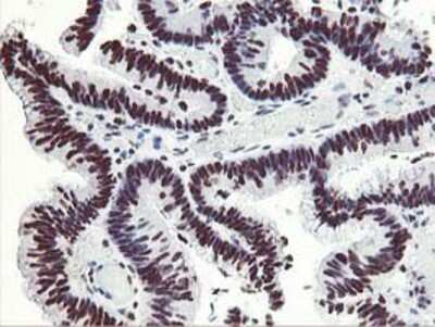 Immunohistochemistry-Paraffin: HOXC11 Antibody (OTI3E10) [NBP2-00499]