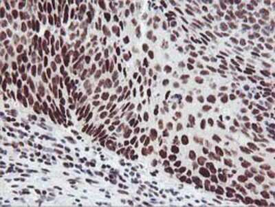 Immunohistochemistry-Paraffin: HOXC11 Antibody (OTI3E10) [NBP2-00499]